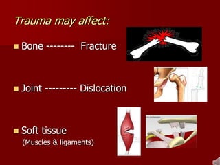 Trauma may affect:
 Bone -------- Fracture
 Joint --------- Dislocation
 Soft tissue
(Muscles & ligaments)
 