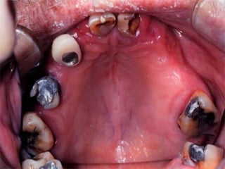 1 introduction-and-classification