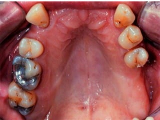 1 introduction-and-classification