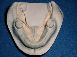 1 introduction-and-classification