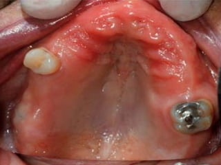 1 introduction-and-classification