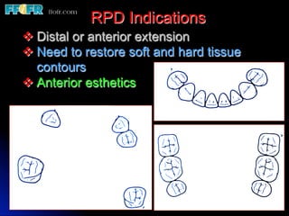 All Rpd Files 1.introduction and basic components of rpd's copy | PDF