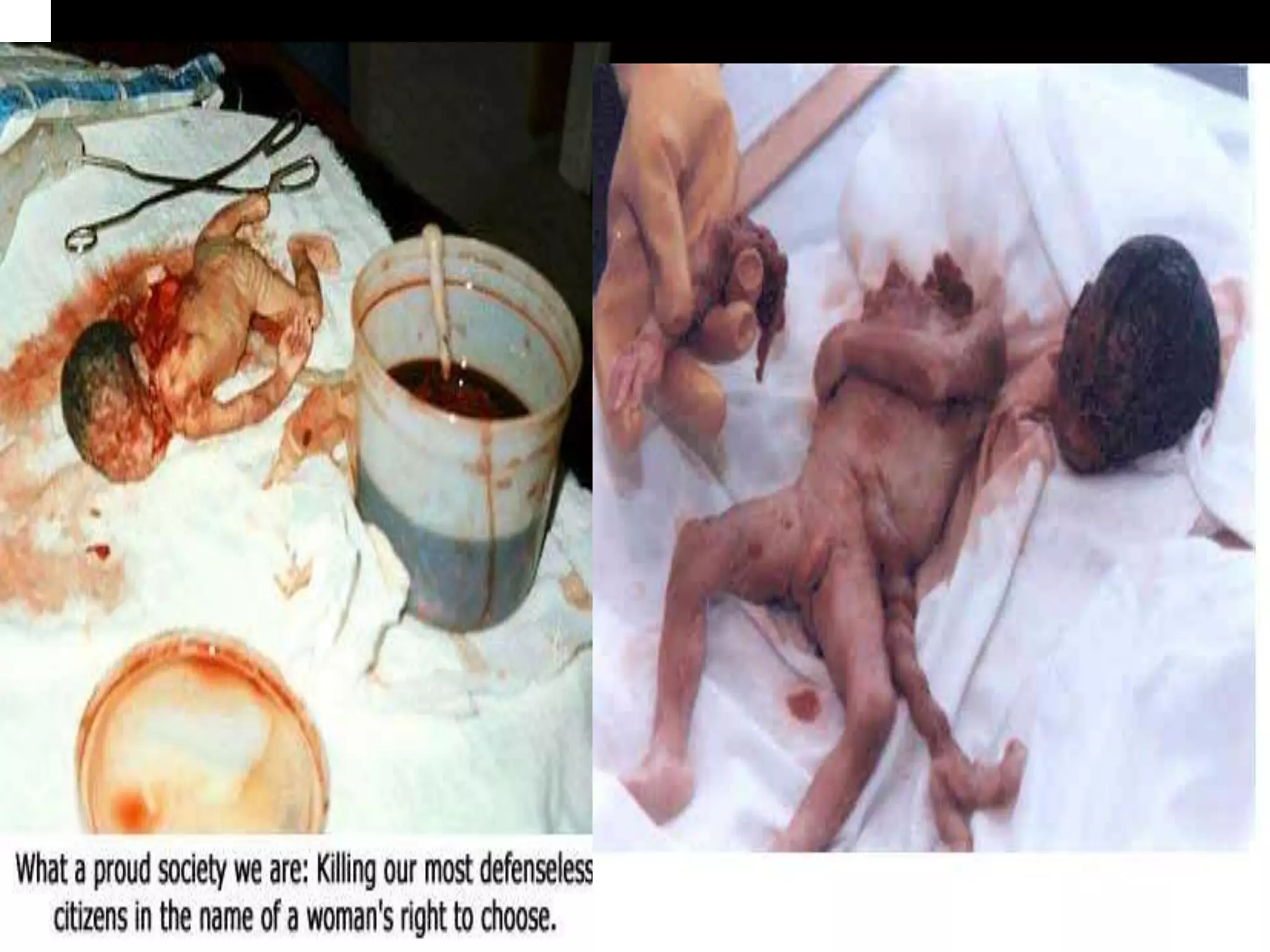 1.  introduction to bioethics