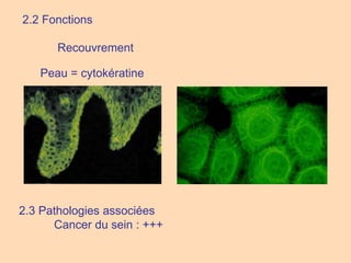2.2 Fonctions
Recouvrement
Peau = cytokératine
2.3 Pathologies associées
Cancer du sein : +++
 