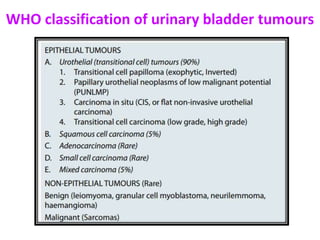 WHO classification of urinary bladder tumours
 