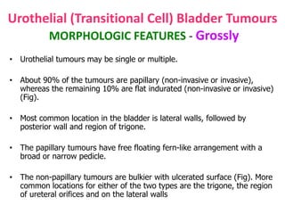 Urothelial (Transitional Cell) Bladder Tumours
MORPHOLOGIC FEATURES - Grossly
• Urothelial tumours may be single or multiple.
• About 90% of the tumours are papillary (non-invasive or invasive),
whereas the remaining 10% are flat indurated (non-invasive or invasive)
(Fig).
• Most common location in the bladder is lateral walls, followed by
posterior wall and region of trigone.
• The papillary tumours have free floating fern-like arrangement with a
broad or narrow pedicle.
• The non-papillary tumours are bulkier with ulcerated surface (Fig). More
common locations for either of the two types are the trigone, the region
of ureteral orifices and on the lateral walls
 