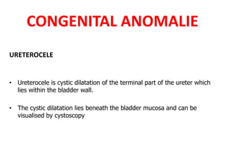 CONGENITAL ANOMALIE
URETEROCELE
• Ureterocele is cystic dilatation of the terminal part of the ureter which
lies within the bladder wall.
• The cystic dilatation lies beneath the bladder mucosa and can be
visualised by cystoscopy
 