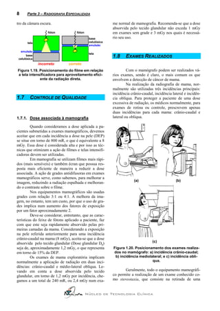8      Parte 3 – RADIOGRAFIA ESPECIALIZADA

tro da câmara escura.                                      me normal de mamografia. Recomenda-se que a dose
                                                           absorvida pelo tecido glandular não exceda 1 mGy
                   fóton             fóton                 em exames sem grade e 3 mGy nos quais é necessá-
                                              base         rio seu uso.
       tela                                   celulósica
                                              emulsão

  emulsão
                                              tela
      base
 celulósica
                                                           1.8     EXAMES REALIZADOS
              incorreto        correto
Figura 1.19. Posicionamento do filme em relação                     Com o mamógrafo podem ser realizados vá-
a tela intensificadora para aproveitamento efici-          rios exames, sendo é claro, o mais comum os que
             ente da radiação direta.                      envolvem a detecção de câncer de mama.
                                                                    Na realização da radiografia de mama, nor-
                                                           malmente são utilizadas três incidências principais:
                                                           incidência crânio-caudal, incidência lateral e incidên-
1.7      CONTROLE DE QUALIDADE                             cia oblíqua. Para proteger a paciente de uma dose
                                                           excessiva de radiação, os médicos normalmente, para
                                                           exames de rotina ou controle, prescrevem apenas
                                                           duas incidências para cada mama: crânio-caudal e
1.7.1. Dose associada à mamografia                         lateral ou oblíqua.

         Quando consideramos a dose aplicada a pa-
cientes submetidas a exames mamográficos, devemos
aceitar que em cada incidência a dose na pele (DEP)
se situe em torno de 800 mR, o que é equivalente a 8
mGy. Essa dose é considerada alta e por isso as téc-
nicas que otimizam a ação de filmes e telas intensifi-
cadoras devem ser utilizadas.
         Em mamografia se utilizam filmes mais rápi-
dos (mais sensíveis) e também écran que possua res-
posta mais eficiente de maneira a reduzir a dose
associada. A ação de grades antidifusoras em exames
mamográficos serve, como sabemos, para melhorar a
                                                                        (a)                       (b)
imagem, reduzindo a radiação espalhada e melhoran-
do o contraste sobre o filme.
         Nos equipamentos mamográficos são usadas
grades com relação 3:1 ou 4:1. A melhora da ima-
gem, no entanto, tem um custo, por que o uso de gra-
des implica num aumento dos fatores de exposição
por um fator aproximadamente 2.
         Deve-se considerar, entretanto, que as carac-
terísticas do feixe de fótons aplicado a paciente, faz
com que este seja rapidamente absorvido pelas pri-
meiras camadas da mama. Considerando a exposição
na pele referida anteriormente para uma incidência
crânio-caudal na mama (8 mGy), aceita-se que a dose
                                                                                   (c)
absorvida pelo tecido glandular (Dose glandular Dg)
seja de, aproximadamente 1,2 mGy, o que representa         Figura 1.20. Posicionamento dos exames realiza-
em torno de 15% da DEP.                                    dos no mamógrafo: a) incidência crânio-caudal;
         Os exames de mama exploratória implicam            b) incidência mediolateral; e c) incidência oblí-
normalmente a aplicação de radiação em duas inci-                                qua.
dências: crânio-caudal e médio-lateral oblíqua. Le-
vando em conta a dose absorvida pelo tecido                       Geralmente, todo o equipamento mamográfi-
glandular, em torno de 1,2 mGy por incidência, che-        co permite a realização de um exame conhecido co-
gamos a um total de 240 mR, ou 2,4 mGy num exa-            mo stereotaxia, que consiste na retirada de uma


                                             Núcleo de Tecnologia Clínica
 