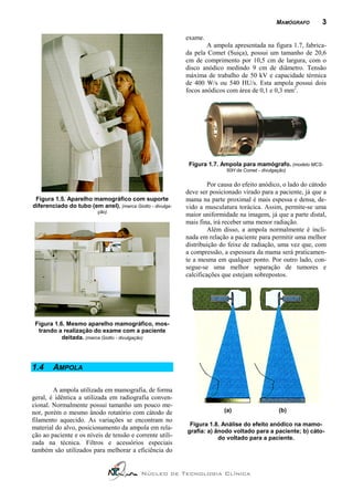 MAMÓGRAFO       3

                                                           exame.
                                                                   A ampola apresentada na figura 1.7, fabrica-
                                                           da pela Comet (Suiça), possui um tamanho de 20,6
                                                           cm de comprimento por 10,5 cm de largura, com o
                                                           disco anódico medindo 9 cm de diâmetro. Tensão
                                                           máxima de trabalho de 50 kV e capacidade térmica
                                                           de 400 W/s ou 540 HU/s. Esta ampola possui dois
                                                           focos anódicos com área de 0,1 e 0,3 mm2.




                                                            Figura 1.7. Ampola para mamógrafo. (modelo MCS-
                                                                          50H da Comet - divulgação)


                                                                    Por causa do efeito anódico, o lado do cátodo
                                                           deve ser posicionado virado para a paciente, já que a
 Figura 1.5. Aparelho mamográfico com suporte              mama na parte proximal é mais espessa e densa, de-
diferenciado do tubo (em anel). (marca Giotto - divulga-   vido a musculatura torácica. Assim, permite-se uma
                          ção)
                                                           maior uniformidade na imagem, já que a parte distal,
                                                           mais fina, irá receber uma menor radiação.
                                                                    Além disso, a ampola normalmente é incli-
                                                           nada em relação a paciente para permitir uma melhor
                                                           distribuição do feixe de radiação, uma vez que, com
                                                           a compressão, a espessura da mama será praticamen-
                                                           te a mesma em qualquer ponto. Por outro lado, con-
                                                           segue-se uma melhor separação de tumores e
                                                           calcificações que estejam sobrepostos.




 Figura 1.6. Mesmo aparelho mamográfico, mos-
  trando a realização do exame com a paciente
           deitada. (marca Giotto - divulgação)




1.4     AMPOLA

        A ampola utilizada em mamografia, de forma
geral, é idêntica a utilizada em radiografia conven-
cional. Normalmente possui tamanho um pouco me-
nor, porém o mesmo ânodo rotatório com cátodo de                         (a)                    (b)
filamento aquecido. As variações se encontram no
                                                            Figura 1.8. Análise do efeito anódico na mamo-
material do alvo, posicionamento da ampola em rela-
                                                           grafia: a) ânodo voltado para a paciente; b) cáto-
ção ao paciente e os níveis de tensão e corrente utili-                do voltado para a paciente.
zada na técnica. Filtros e acessórios especiais
também são utilizados para melhorar a eficiência do


                                           Núcleo de Tecnologia Clínica
 