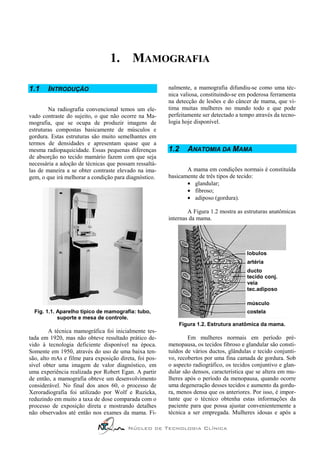1. MAMOGRAFIA

1.1    INTRODUÇÃO                                       nalmente, a mamografia difundiu-se como uma téc-
                                                        nica valiosa, constituindo-se em poderosa ferramenta
                                                        na detecção de lesões e do câncer de mama, que vi-
        Na radiografia convencional temos um ele-       tima muitas mulheres no mundo todo e que pode
vado contraste do sujeito, o que não ocorre na Ma-      perfeitamente ser detectado a tempo através da tecno-
mografia, que se ocupa de produzir imagens de           logia hoje disponível.
estruturas compostas basicamente de músculos e
gordura. Estas estruturas são muito semelhantes em
termos de densidades e apresentam quase que a
mesma radiopaquicidade. Essas pequenas diferenças       1.2    ANATOMIA DA MAMA
de absorção no tecido mamário fazem com que seja
necessária a adoção de técnicas que possam ressaltá-
las de maneira a se obter contraste elevado na ima-            A mama em condições normais é constituída
gem, o que irá melhorar a condição para diagnóstico.    basicamente de três tipos de tecido:
                                                               • glandular;
                                                               • fibroso;
                                                               • adiposo (gordura).

                                                                A Figura 1.2 mostra as estruturas anatômicas
                                                        internas da mama.




                                                                                        lobulos
                                                                                        artéria
                                                                                        ducto
                                                                                        tecido conj.
                                                                                        veia
                                                                                        tec.adiposo

                                                                                        músculo
  Fig. 1.1. Aparelho típico de mamografia: tubo,                                        costela
            suporte e mesa de controle.
                                                            Figura 1.2. Estrutura anatômica da mama.
         A técnica mamográfica foi inicialmente tes-
tada em 1920, mas não obteve resultado prático de-              Em mulheres normais em período pré-
vido à tecnologia deficiente disponível na época.       menopausa, os tecidos fibroso e glandular são consti-
Somente em 1950, através do uso de uma baixa ten-       tuídos de vários ductos, glândulas e tecido conjunti-
são, alto mAs e filme para exposição direta, foi pos-   vo, recobertos por uma fina camada de gordura. Sob
sível obter uma imagem de valor diagnóstico, em         o aspecto radiográfico, os tecidos conjuntivo e glan-
uma experiência realizada por Robert Egan. A partir     dular são densos, característica que se altera em mu-
de então, a mamografia obteve um desenvolvimento        lheres após o período da menopausa, quando ocorre
considerável. No final dos anos 60, o processo de       uma degeneração desses tecidos e aumento da gordu-
Xeroradiografia foi utilizado por Wolf e Ruzicka,       ra, menos densa que os anteriores. Por isso, é impor-
reduzindo em muito a taxa de dose comparada com o       tante que o técnico obtenha estas informações da
processo de exposição direta e mostrando detalhes       paciente para que possa ajustar convenientemente a
não observados até então nos exames da mama. Fi-        técnica a ser empregada. Mulheres idosas e após a

                                         Núcleo de Tecnologia Clínica
 