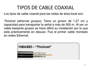 TIPOS DE CABLE COAXIAL
30
Los tipos de cable coaxial para las redes de área local son:
Thicknet (ethernet grueso): Tiene un grosor de 1,27 cm y
capacidad para transportar la señal a más de 500 m. Al ser un
cable bastante grueso se hace difícil su instalación por lo que
está prácticamente en desuso. Fue el primer cable montado
en redes Ethernet.
 