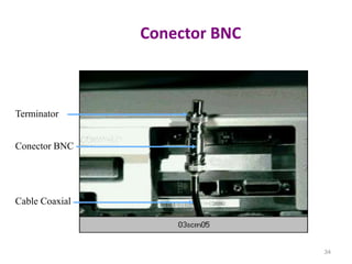 Conector BNC
34
Terminator
Conector BNC
Cable Coaxial
 
