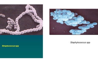 Staphylococcus spp
 