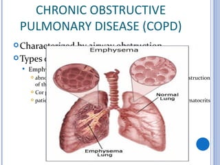 1.mnt for pulmonary diseases | PPT