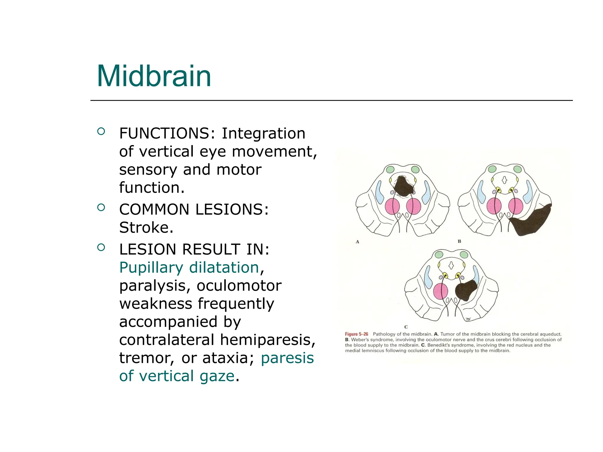 Midbrain
 FUNCTIONS: Integration
of vertical eye movement,
sensory and motor
function.
 COMMON LESIONS:
Stroke.
 LESION RESULT IN:
Pupillary dilatation,
paralysis, oculomotor
weakness frequently
accompanied by
contralateral hemiparesis,
tremor, or ataxia; paresis
of vertical gaze.
 