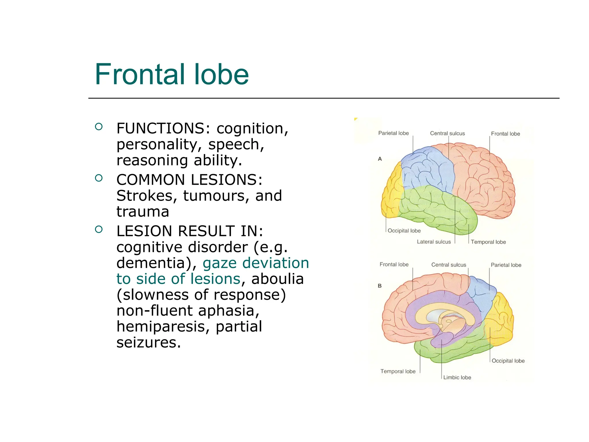 Frontal lobe
 FUNCTIONS: cognition,
personality, speech,
reasoning ability.
 COMMON LESIONS:
Strokes, tumours, and
trauma
 LESION RESULT IN:
cognitive disorder (e.g.
dementia), gaze deviation
to side of lesions, aboulia
(slowness of response)
non-fluent aphasia,
hemiparesis, partial
seizures.
 