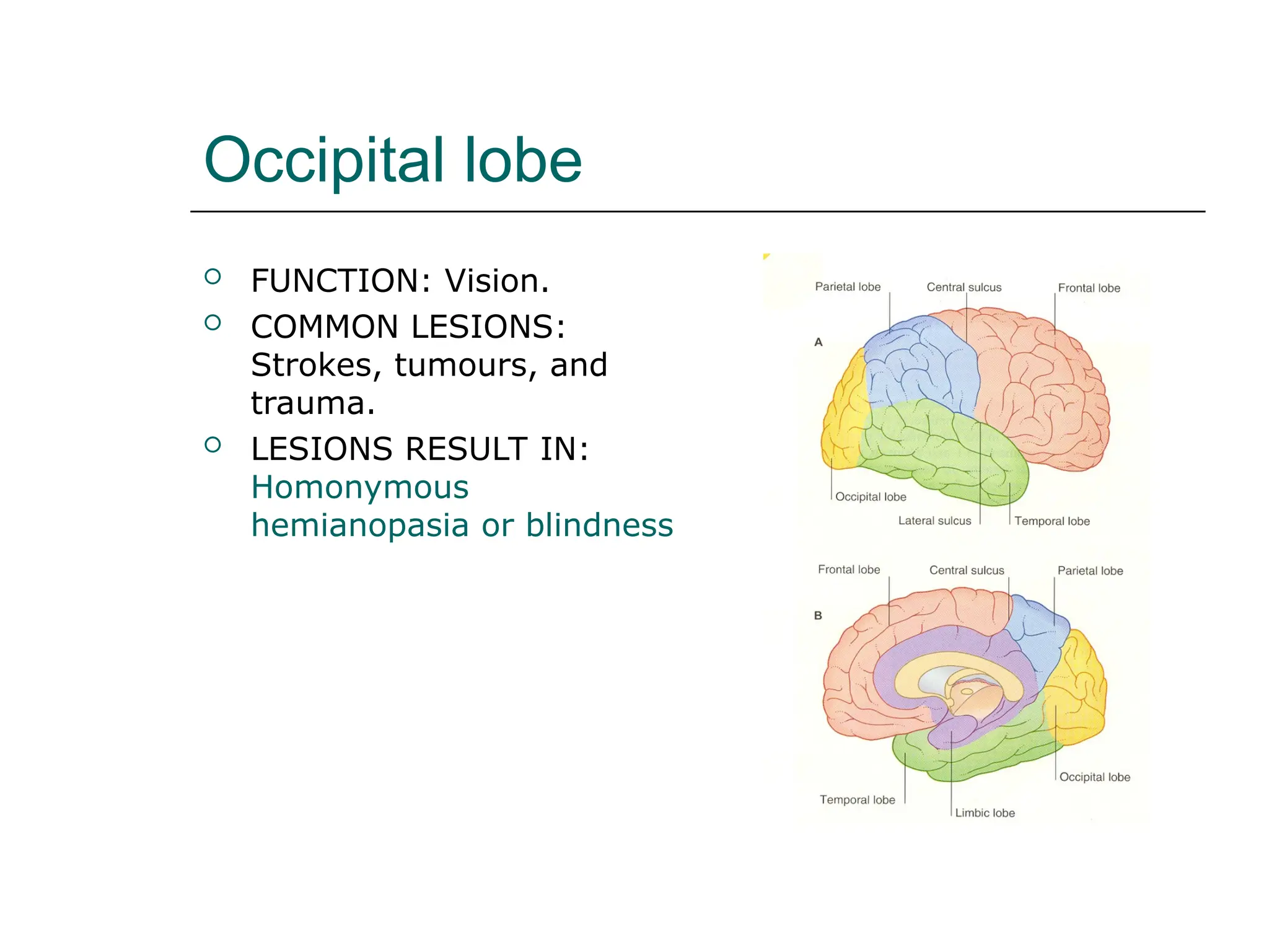 Occipital lobe
 FUNCTION: Vision.
 COMMON LESIONS:
Strokes, tumours, and
trauma.
 LESIONS RESULT IN:
Homonymous
hemianopasia or blindness
 
