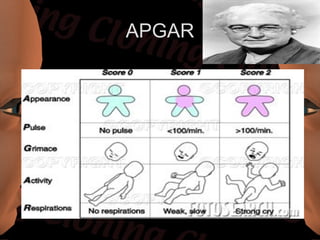 APGAR
 