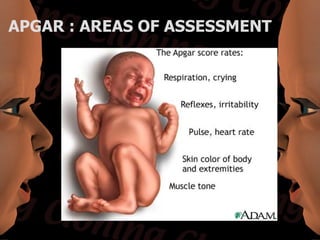 APGAR : AREAS OF ASSESSMENT
 