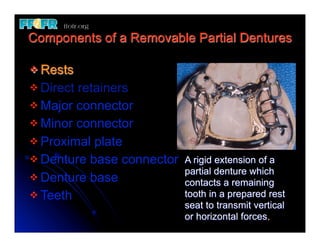 Rest In Rpd 1.(new)introduction and basic components of rpd's | PDF
