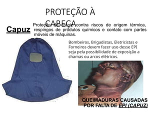 PROTEÇÃO À
CABEÇA
Capuz
Proteção do crânio contra riscos de origem térmica,
respingos de produtos químicos e contato com partes
móveis de máquinas.
QUEIMADURAS CAUSADAS
POR FALTA DE EPI (CAPUZ)
Bombeiros, Brigadistas, Eletricistas e
Forneiros devem fazer uso desse EPI
seja pela possibilidade de exposição a
chamas ou arcos elétricos.
 