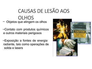 CAUSAS DE LESÃO AOS
OLHOS
– Objetos que atingem os olhos
–Contato com produtos químicos
e outros materiais perigosos
–Exposição a fontes de energia
radiante, tais como operações de
solda e lasers
 