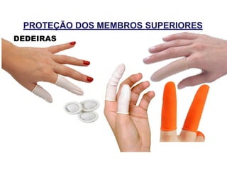 PROTEÇÃO DOS MEMBROS SUPERIORES
DEDEIRAS
 