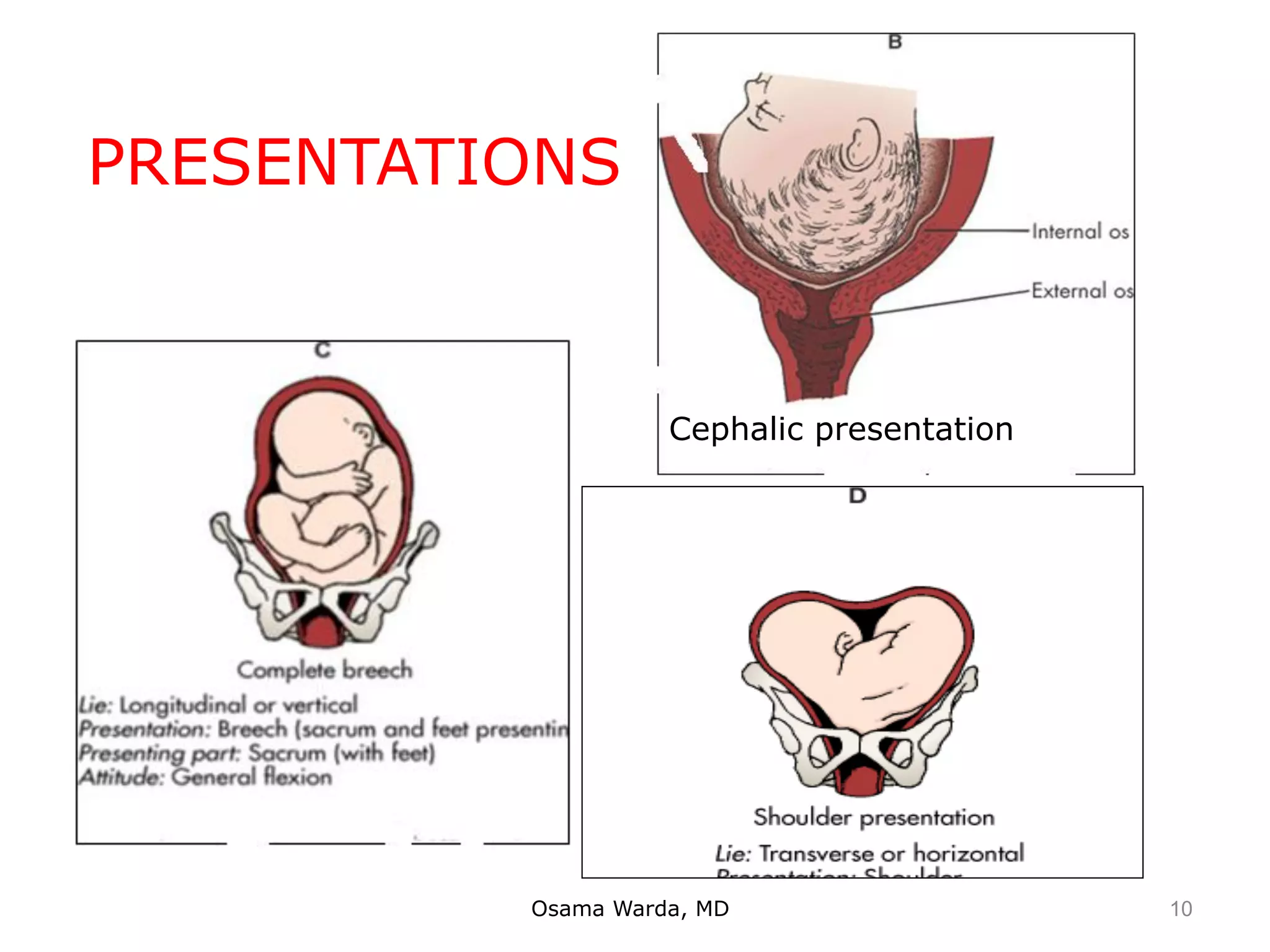 Osama Warda, MD
Cephalic presentation
PRESENTATIONS
10
 