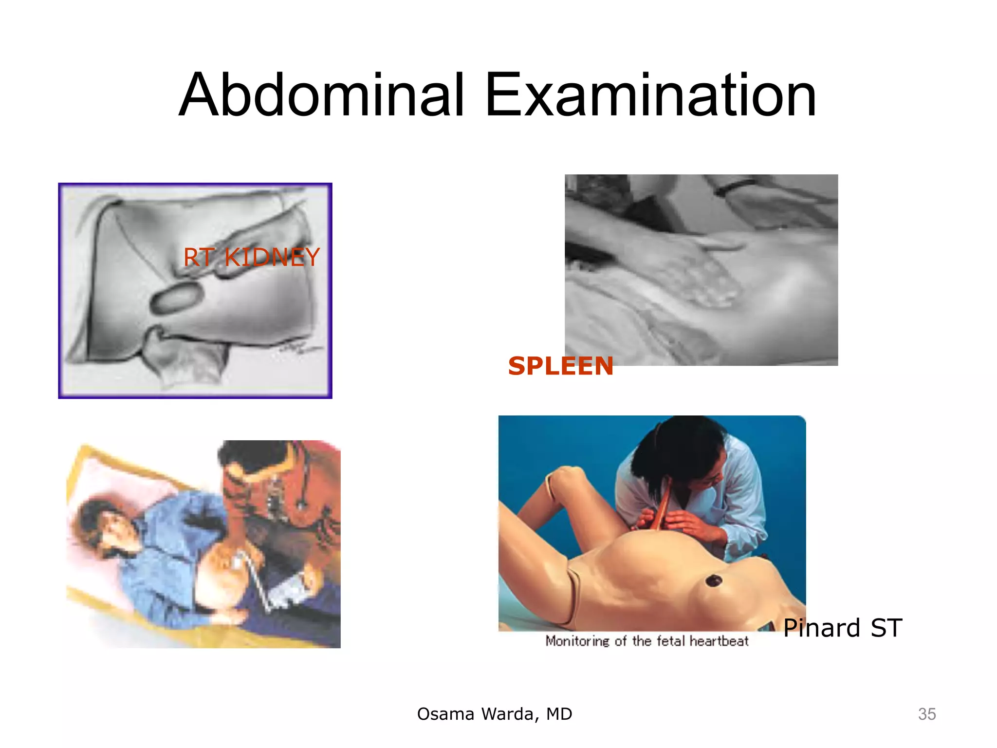 Abdominal Examination
Osama Warda, MD
LIVER
RT KIDNEY
SPLEEN
Pinard ST
35
 