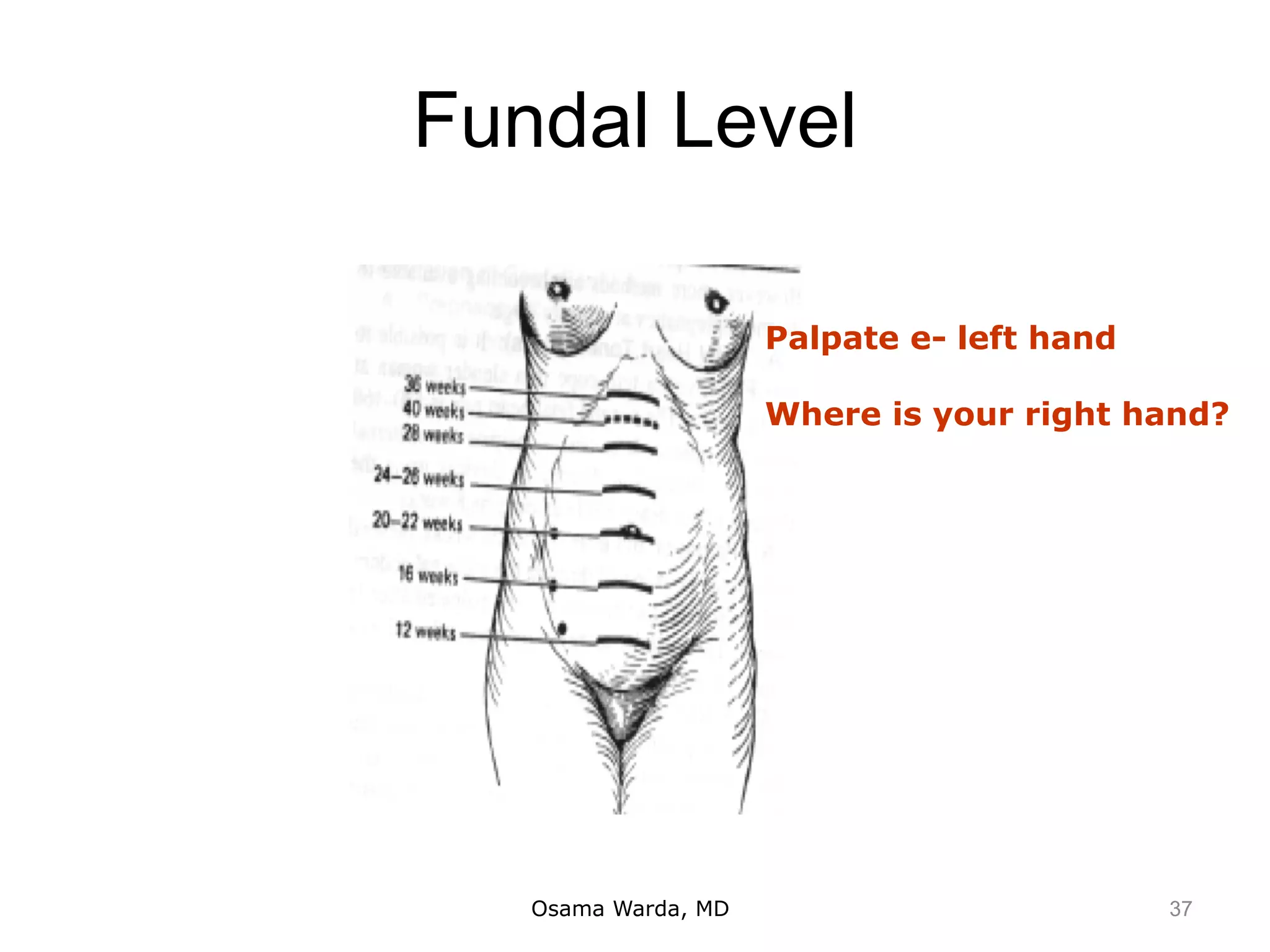 Fundal Level
Osama Warda, MD
Palpate e- left hand
Where is your right hand?
37
 