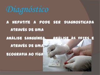 Diagnóstico
A hepatite A pode ser diagnosticada
 através de uma

análise sanguínea,     análise às fezes e
 através de uma

ecografia ao fígado.
 