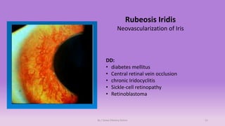 Ophthalmology OSCE | PDF