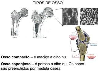 TIPOS DE OSSO




Osso compacto – é maciço a olho nu.
Osso esponjoso – é poroso a olho nu. Os poros
são preenchidos por medula óssea.
 