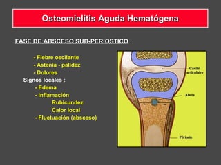 FASE DE ABSCESO SUB-PERIOSTICOFASE DE ABSCESO SUB-PERIOSTICO
- Fiebre oscilante
- Astenia - palidez
- Dolores
Signos locales :
- Edema
- Inflamación
Rubicundez
Calor local
- Fluctuación (absceso)
Osteomielitis Aguda HematógenaOsteomielitis Aguda Hematógena
 
