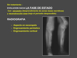 Sin tratamiento :
EVOLUCION HACIA LA FASE DE ESTADO
Con secuestro (desprendimiento de zonas óseas necróticas)
y reconstrucción ósea (bajo el periostio desprendido)
RADIOGRAFIA
– Aspecto en escarapela
– Engrosamiento perióstico
– Engrosamiento cortical
 