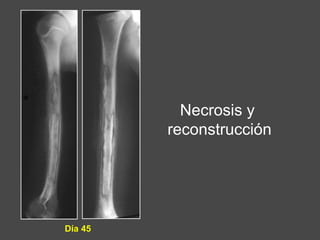 Necrosis y
reconstrucción
Día 45
 
