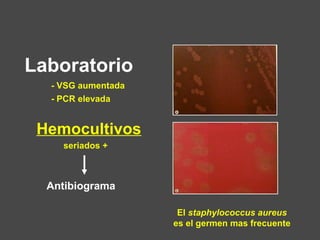 El staphylococcus aureus
es el germen mas frecuente
Laboratorio
- VSG aumentada
- PCR elevada
Hemocultivos
seriados +
Antibiograma
 