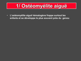 • L’ostéomyélite aiguë hématogène frappe surtout les
enfants et se développe le plus souvent près du genou
1/ Ostéomyélite aiguë
 