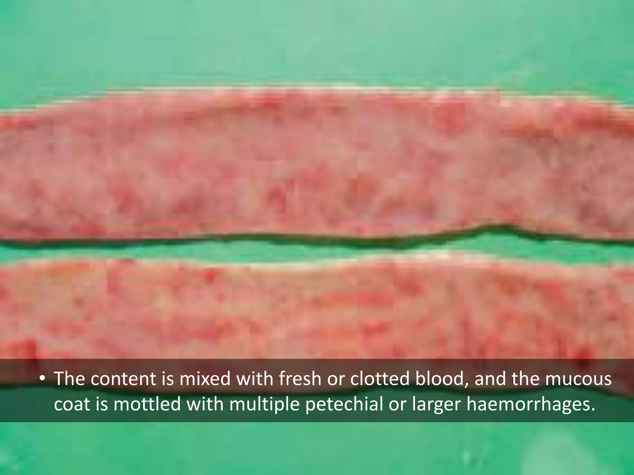 • The content is mixed with fresh or clotted blood, and the mucous
coat is mottled with multiple petechial or larger haemorrhages.
 