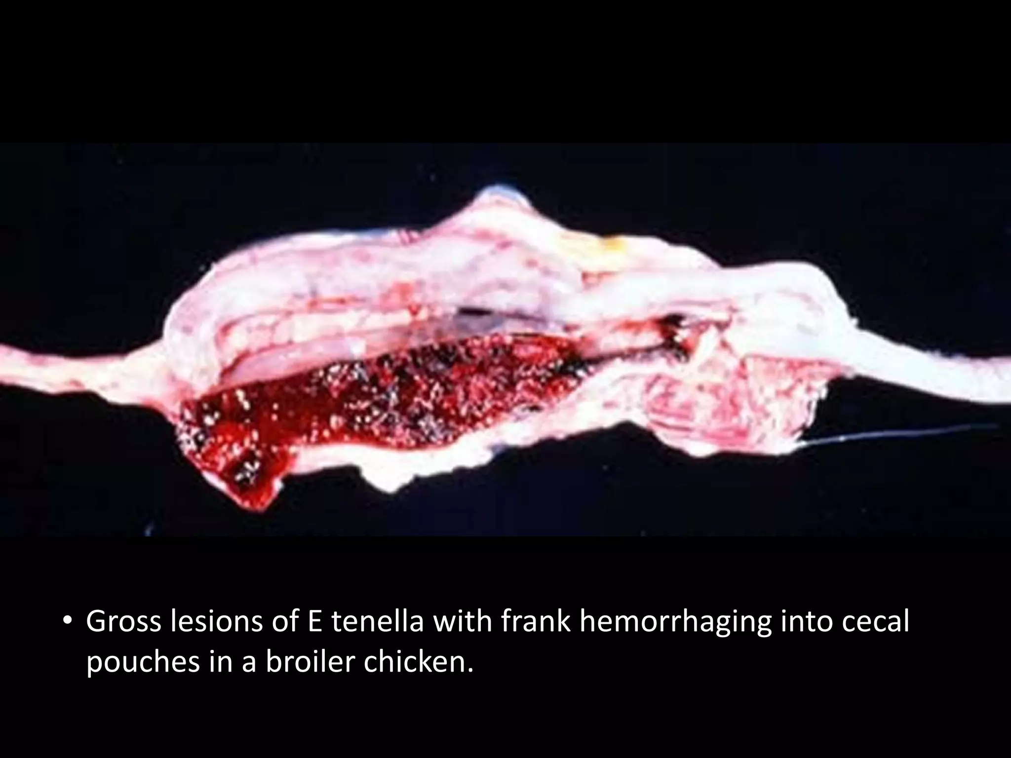 • Gross lesions of E tenella with frank hemorrhaging into cecal
pouches in a broiler chicken.
 