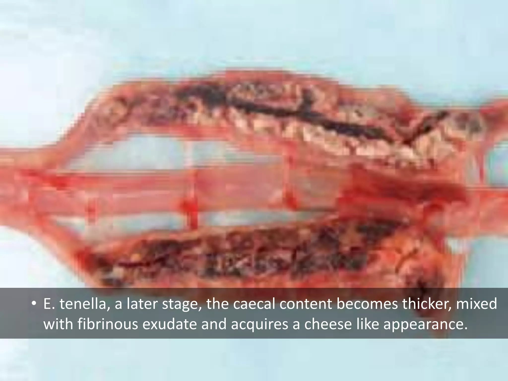 • E. tenella, a later stage, the caecal content becomes thicker, mixed
with fibrinous exudate and acquires a cheese like appearance.
 