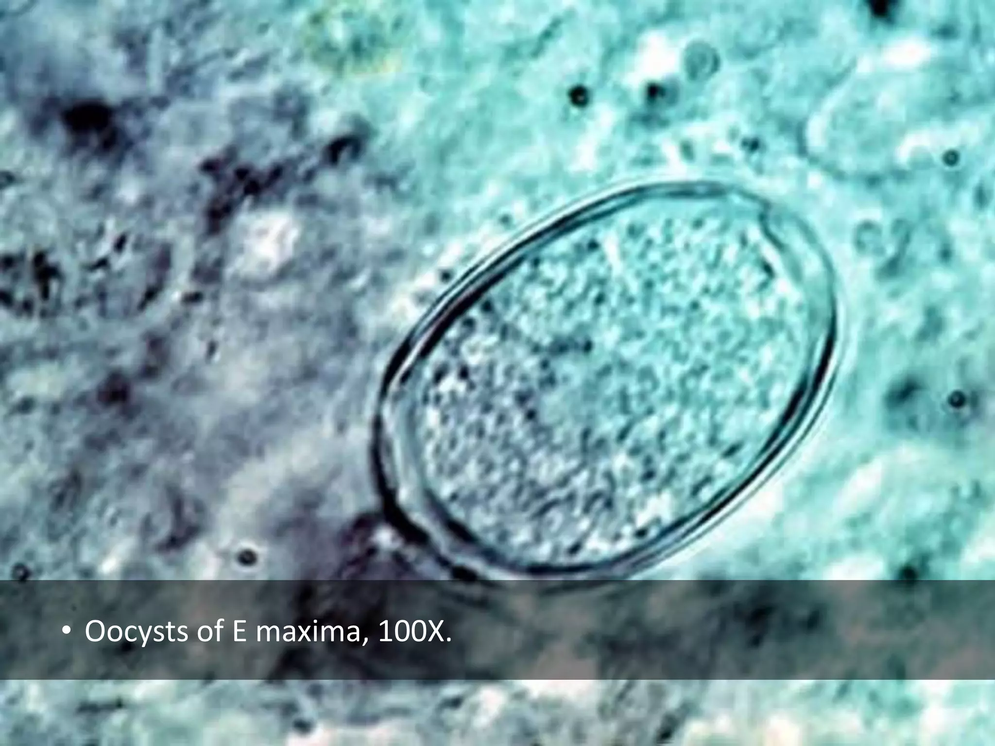 • Oocysts of E maxima, 100X.
 