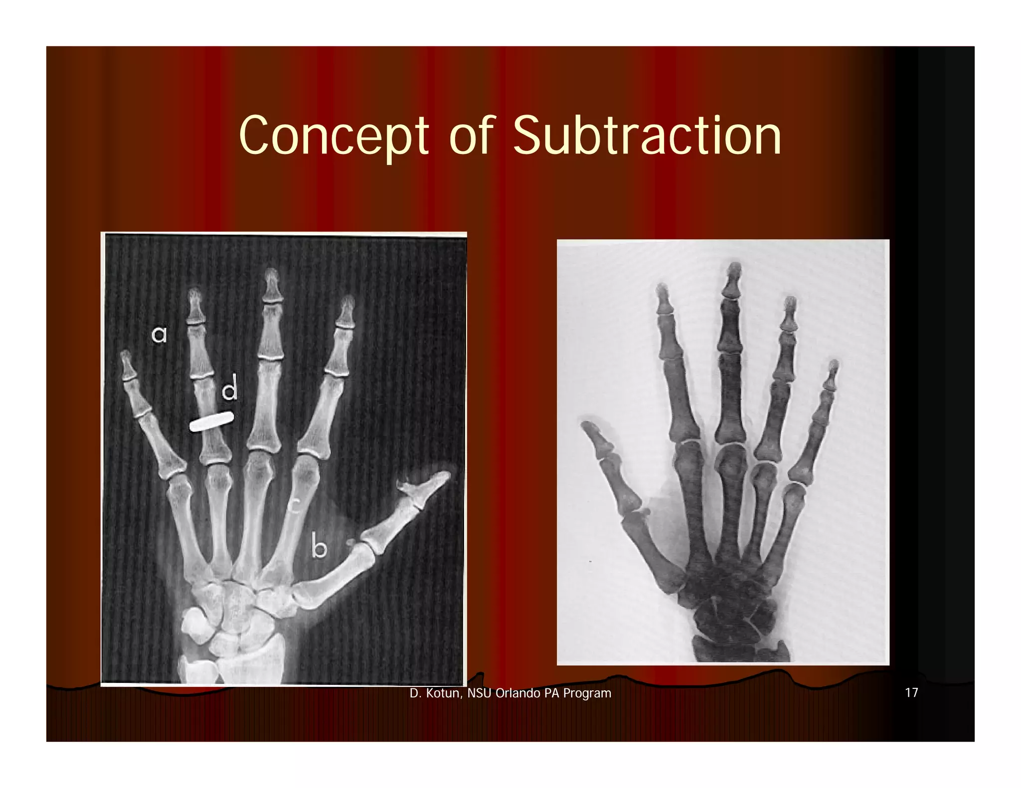 Introduction to Medical Imaging
