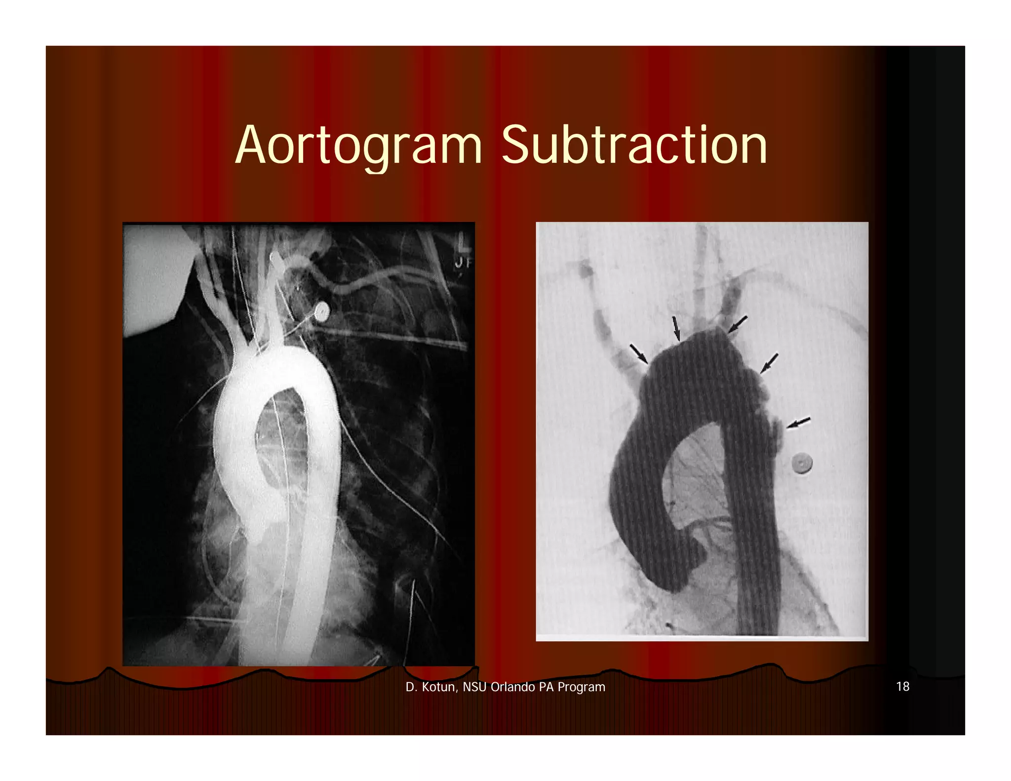 Introduction to Medical Imaging