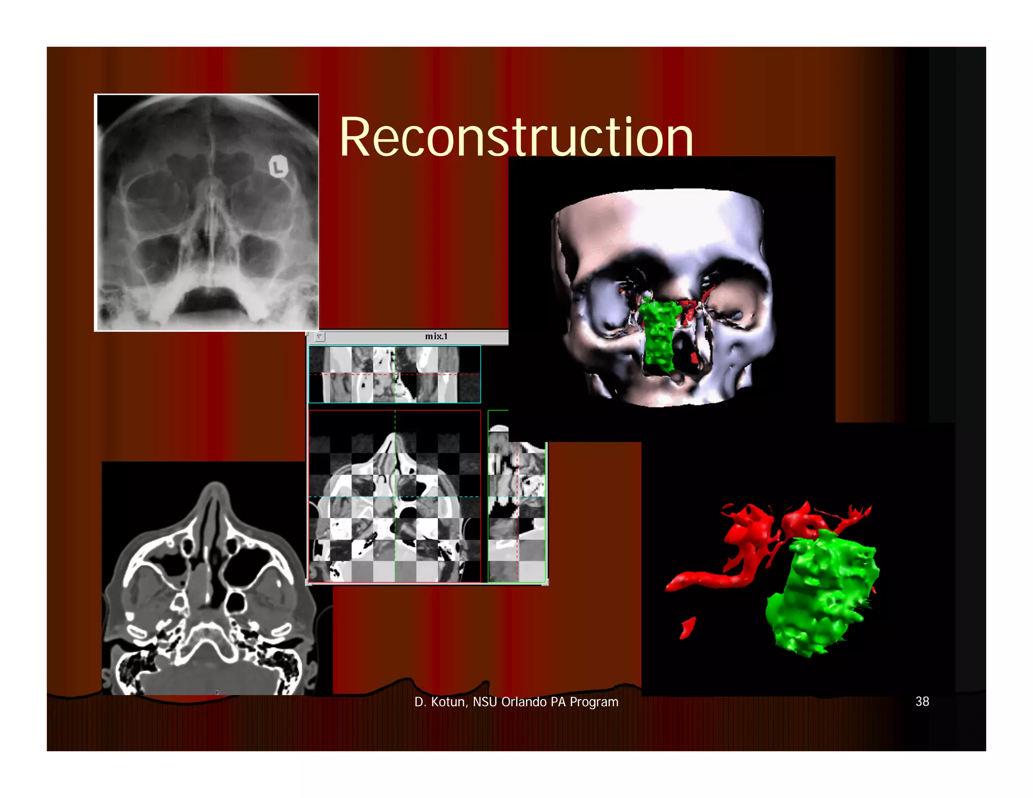 Introduction to Medical Imaging