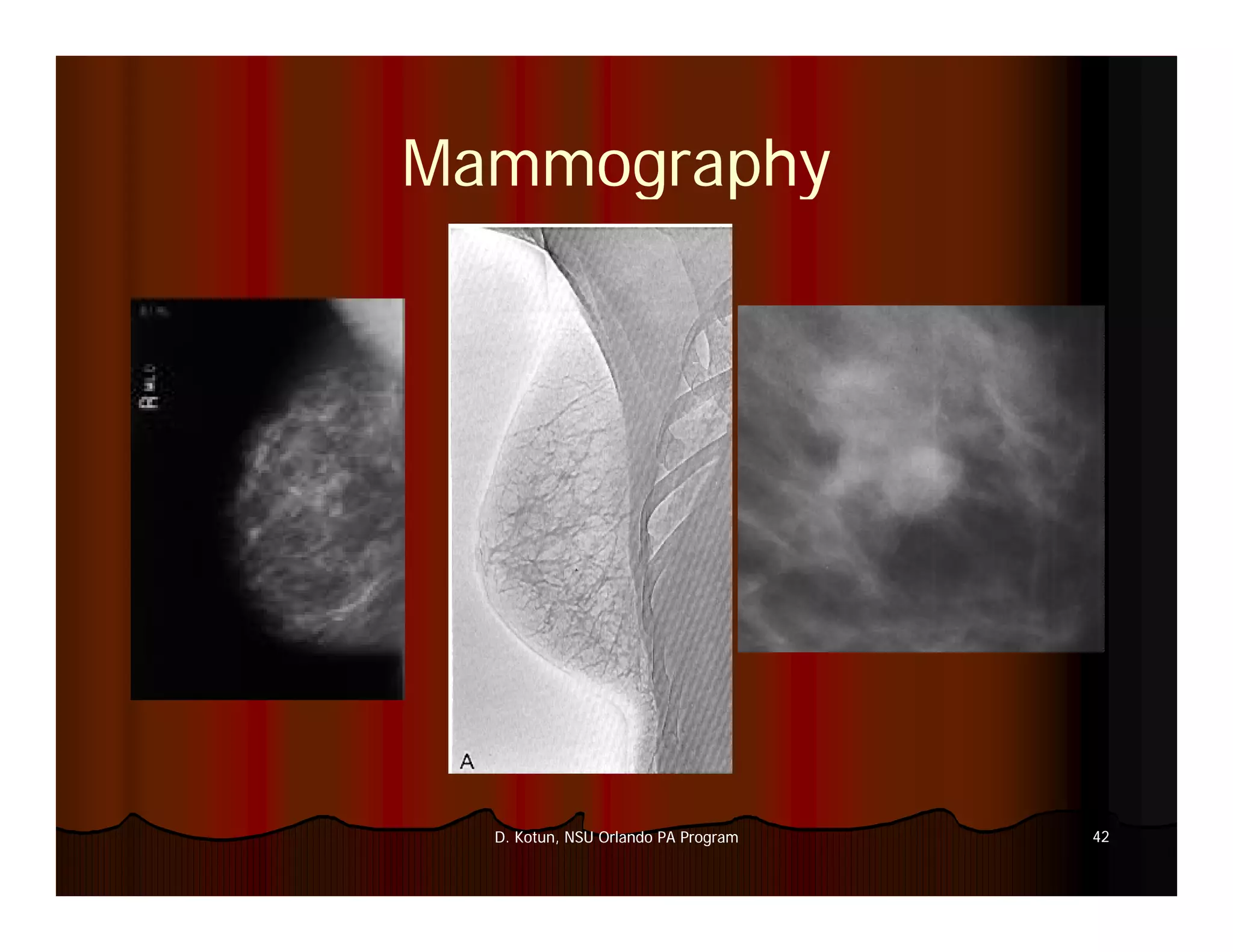 Introduction to Medical Imaging