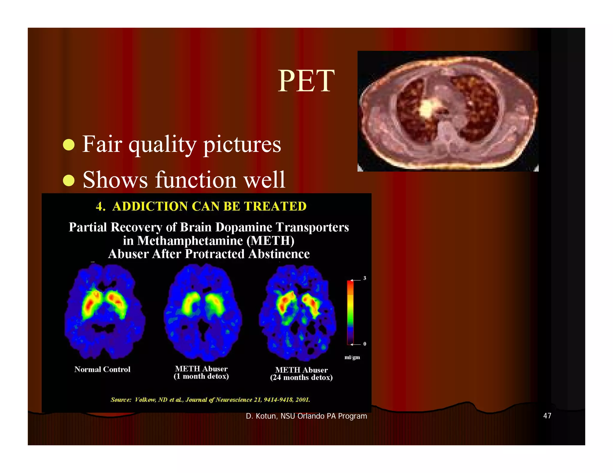 Introduction to Medical Imaging