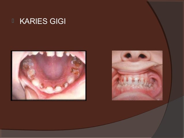 Pengenalan kepada bidang pergigian untuk kumpulan kurang upaya