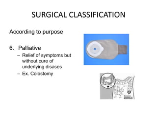 SURGICAL CLASSIFICATION
According to purpose

6. Palliative
   – Relief of symptoms but
     without cure of
     underlying disases
   – Ex. Colostomy
 