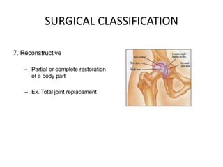 SURGICAL CLASSIFICATION

7. Reconstructive

   – Partial or complete restoration
     of a body part

   – Ex. Total joint replacement
 
